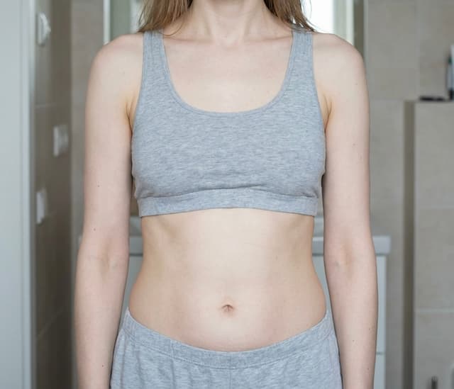 Lisa, 27 — before
